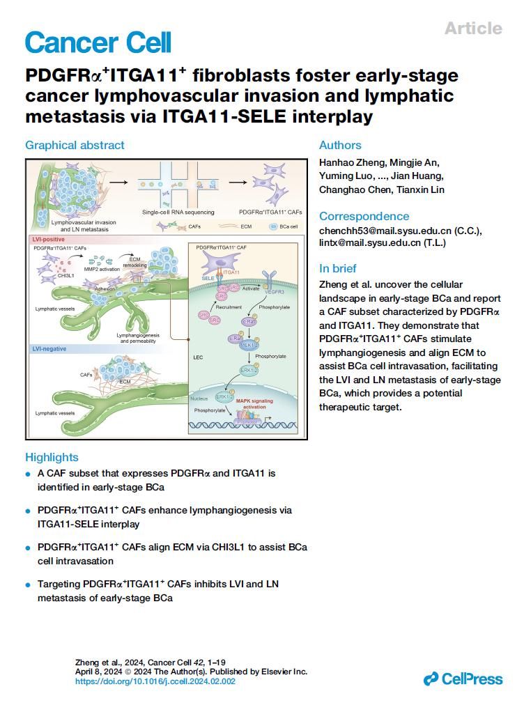 研究揭示早期膀胱癌脈管癌栓形成的關鍵分子機制