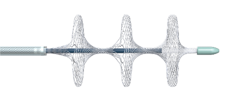 國(guó)內(nèi)首創(chuàng)！本市研發(fā)生產(chǎn)的1款Ⅲ類(lèi)創(chuàng)新醫(yī)療器械獲批上市，為具有溶栓禁忌癥的患者提供了治療選擇